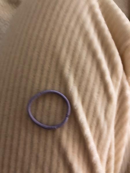 Dcérka zjedla gumičku: Čo robiť?