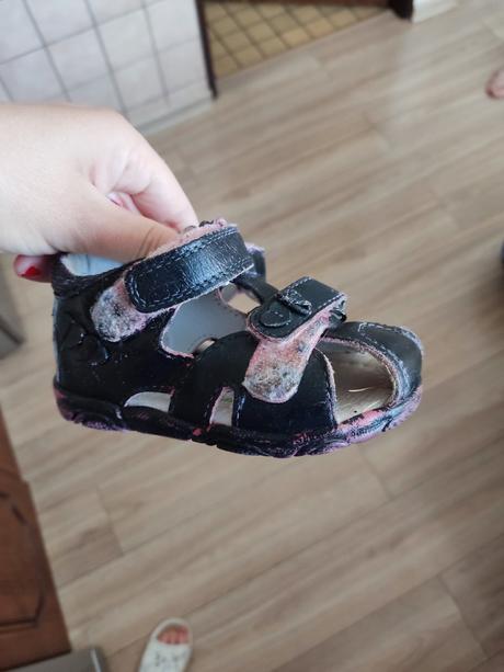 Sandalky, protetika,21