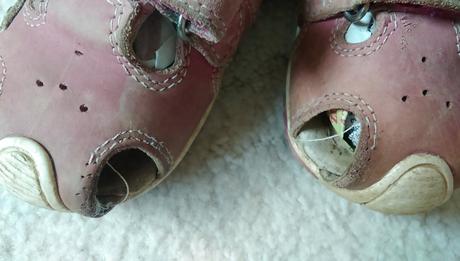 Sandálky 21, protetika,21