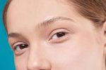 Asymetria očí po blefaroplastike: Je to bežné?