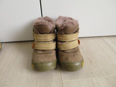 Zimne topanocky, protetika,21