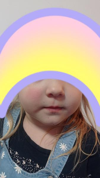 Prečo má štvorročná dcéra teplý červený fľak na líci?