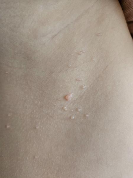 Sú to molusky alebo niečo iné?