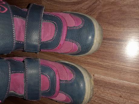 Čižmy sú, protetika,32