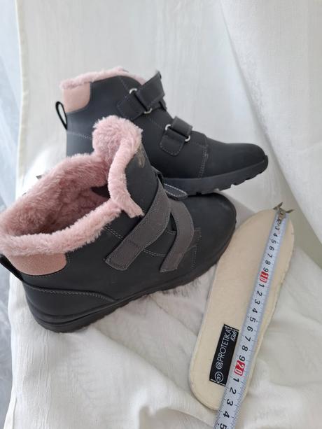 Protetika na jeseň a zimu, protetika,36