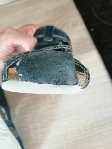 Sandále protetika, protetika,32