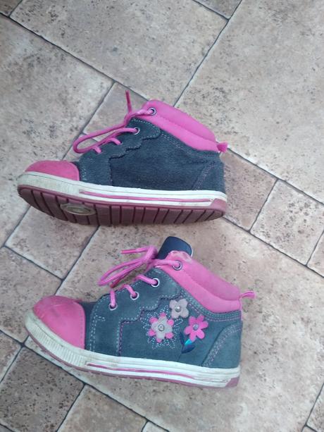 Topanky protetika, protetika,26