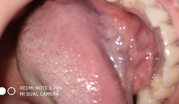 Je môj jazyk v poriadku?