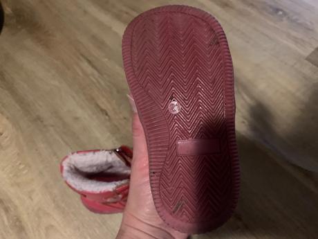 Zimne cizmicky protetika, protetika,21