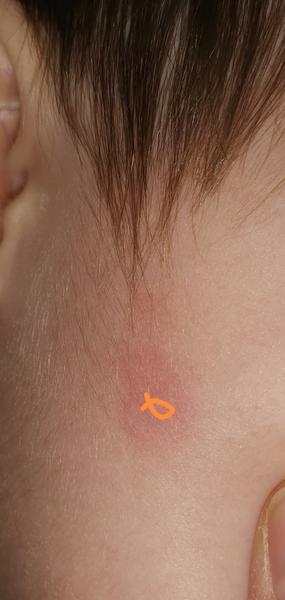 Čo znamenajú tieto malé fľaky?