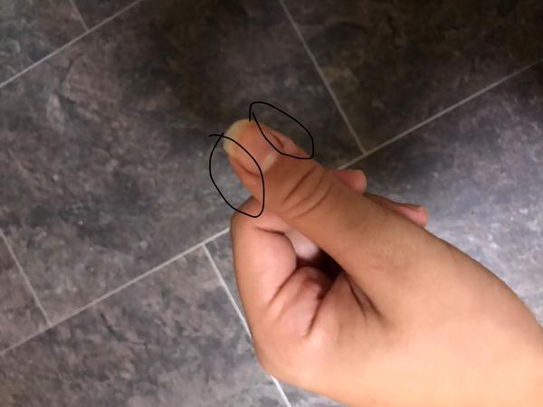 Čo to mám pri nechtoch?