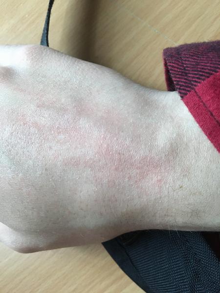 Začala ma svrbieť dlaň