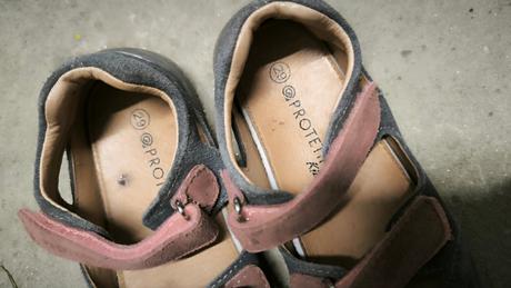 Protetika barefoot sandále, protetika,29