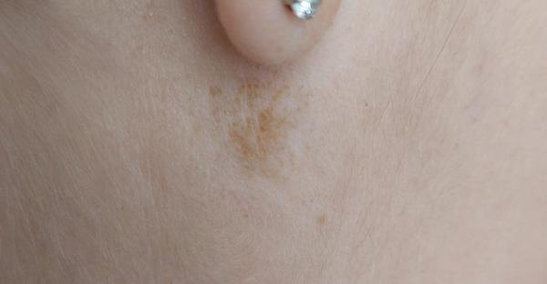 Čo je to za škvrnu?