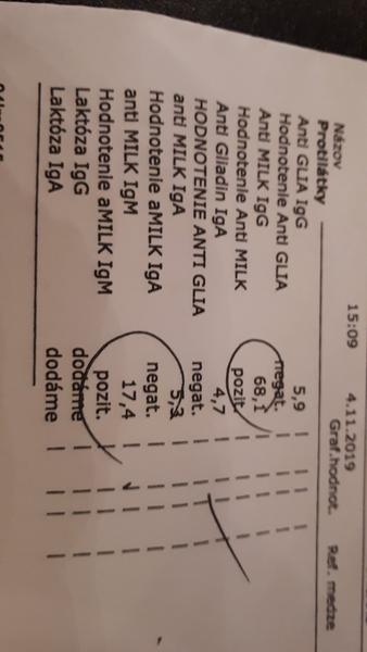 Akú alergiu má moja dcéra?