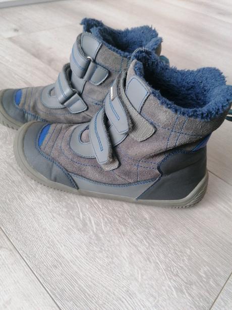 Zimné protetika, protetika,35