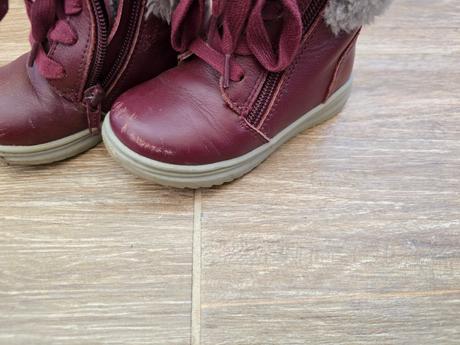 Topánky č.23, protetika,23