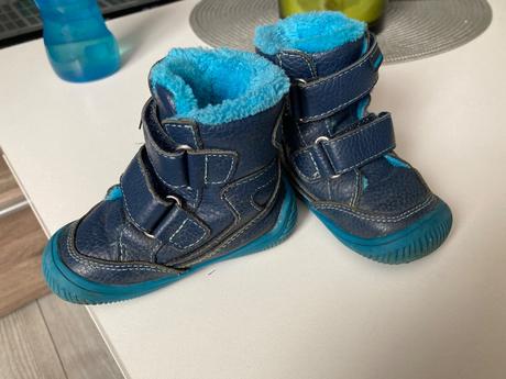 Prechodné topánky protetika, protetika,20