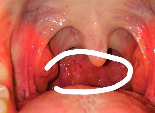 Najlepší krčný lekár v trnavskom kraji