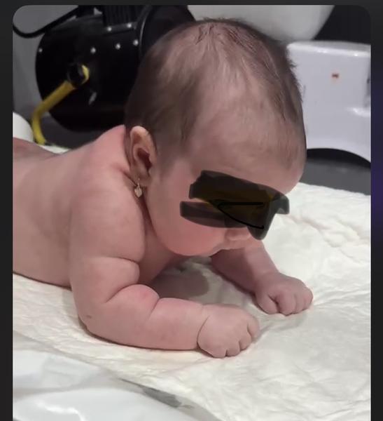 Dvíha 6-týždňové bábätko hlavičku priskoro?