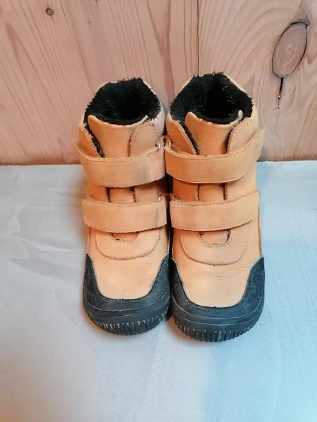 Barefoot protetika, protetika,34