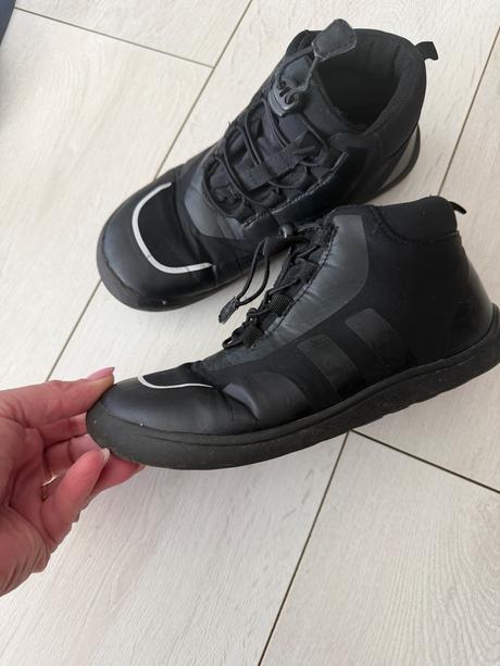 Protetika, protetika,34