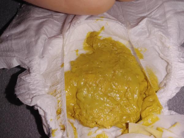 Je stolica môjho trojmesačného bábätka v poriadku?