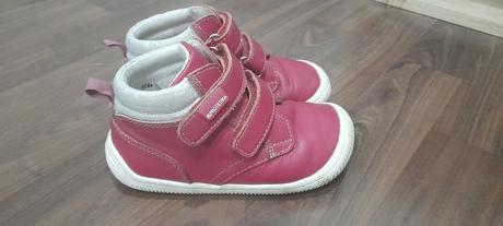 Protetika prechodné barefooot topánočky, protetika,25