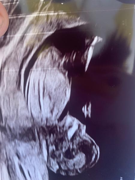 Je to chlapček alebo dievčatko?