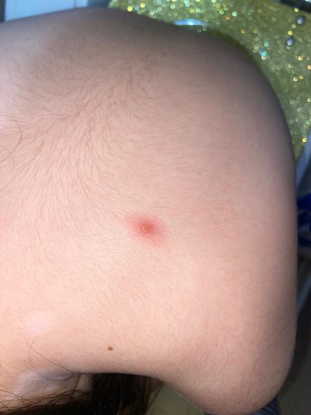 Sú toto ovčie kiahne?