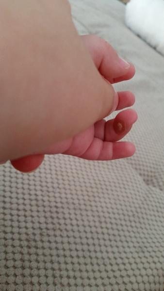 Čo je toto na prste?