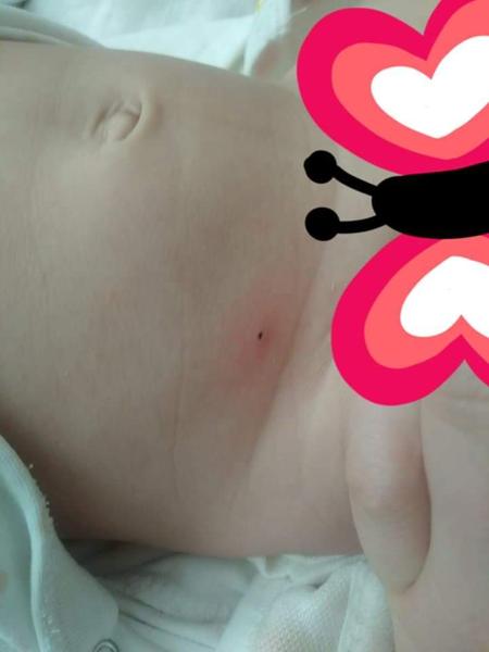 Prečo má moje dieťa takúto čiernu bodku?