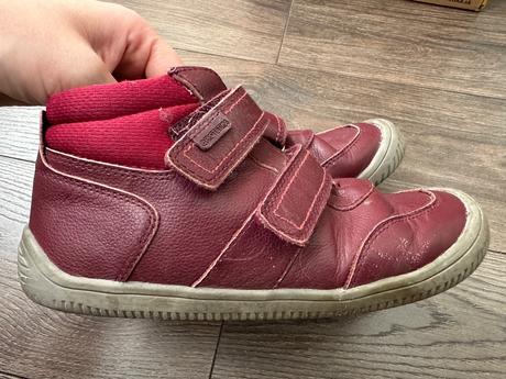 Protetika prechodné topánky, protetika,33