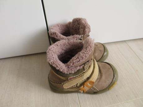 Zimne topanocky, protetika,21