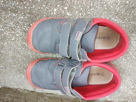 Barefoot tenisky, protetika,35