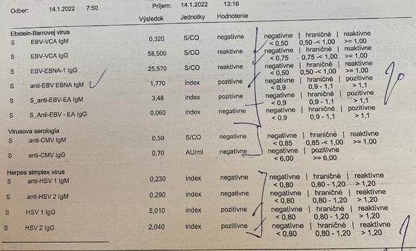 Ako posilniť imunitu, keď cítim únavu a mám EBV?