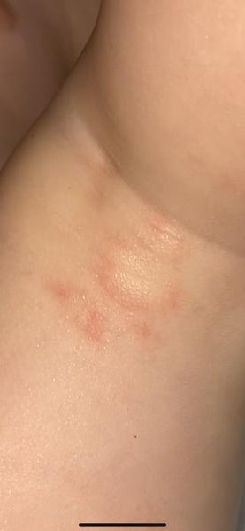 Aký výsyp má moje bábätko?