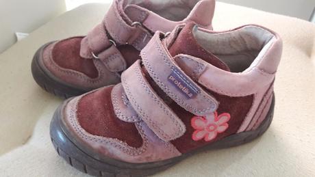 Malo nosene topanky, protetika,24