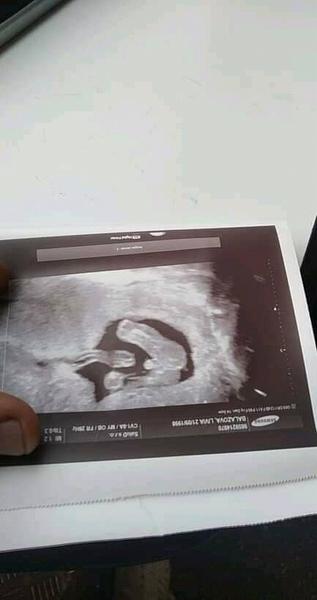 Aké je to pohlavie?