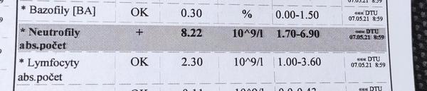 Čo znamenajú znížené trombocyty?