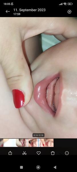 Môžu to byť zúbky?