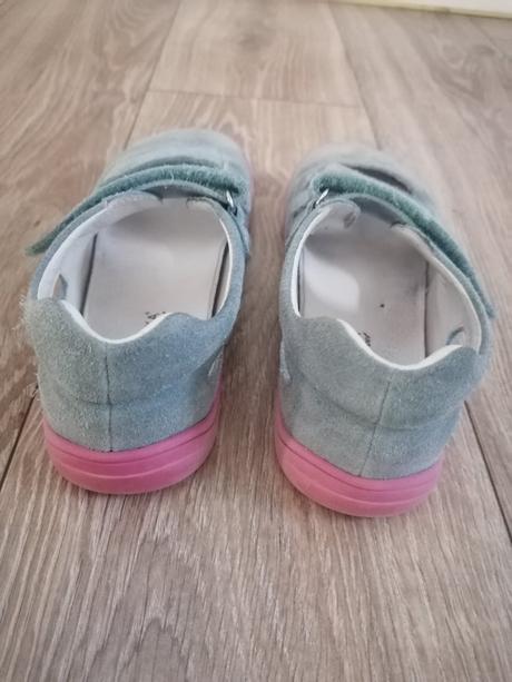 Sandále / prezuvky, protetika,35