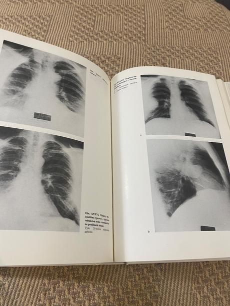 Veľká kniha pre lekárov vnútorne lekárstvo 3,