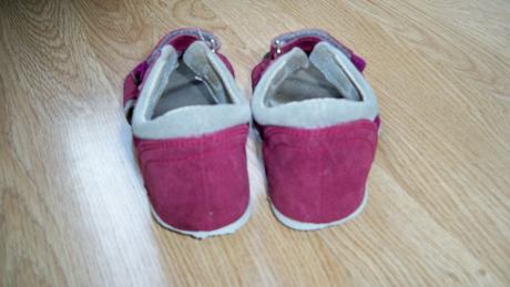 Sandálky- protetika, protetika,29