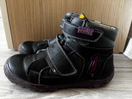 Prechodné topánky od protetiky, protetika,32