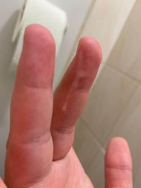 Je to plodný hlien?