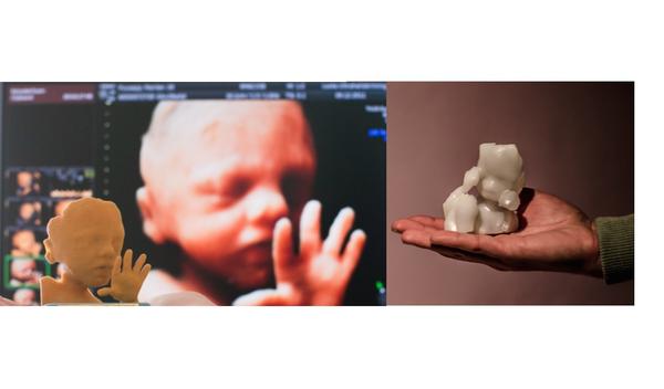 Váš názor na podobu bábätka, ktorá sa dá chytiť do rúk