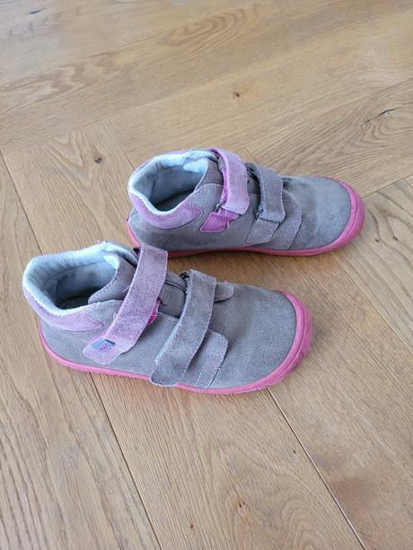 Topanky protetika, protetika,31