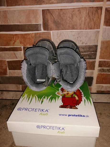 Zimné protetika topánky, protetika,20