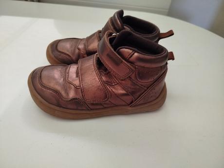 Prechodné topánky, protetika,27